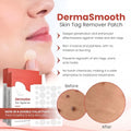 Skin Tag Remover Patch (Buy 1 Get 1 Free)