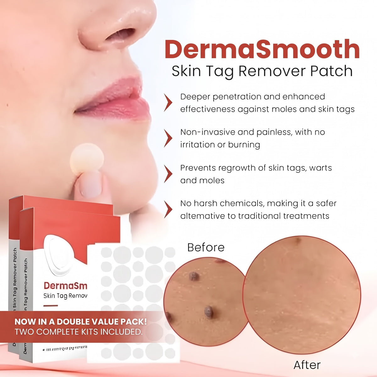 Skin Tag Remover Patch (Buy 1 Get 1 Free)